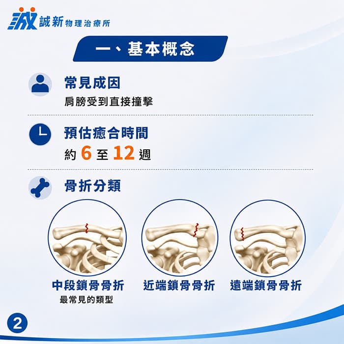 鎖骨骨折常見成因與類型 鎖骨骨折常見成因與類型