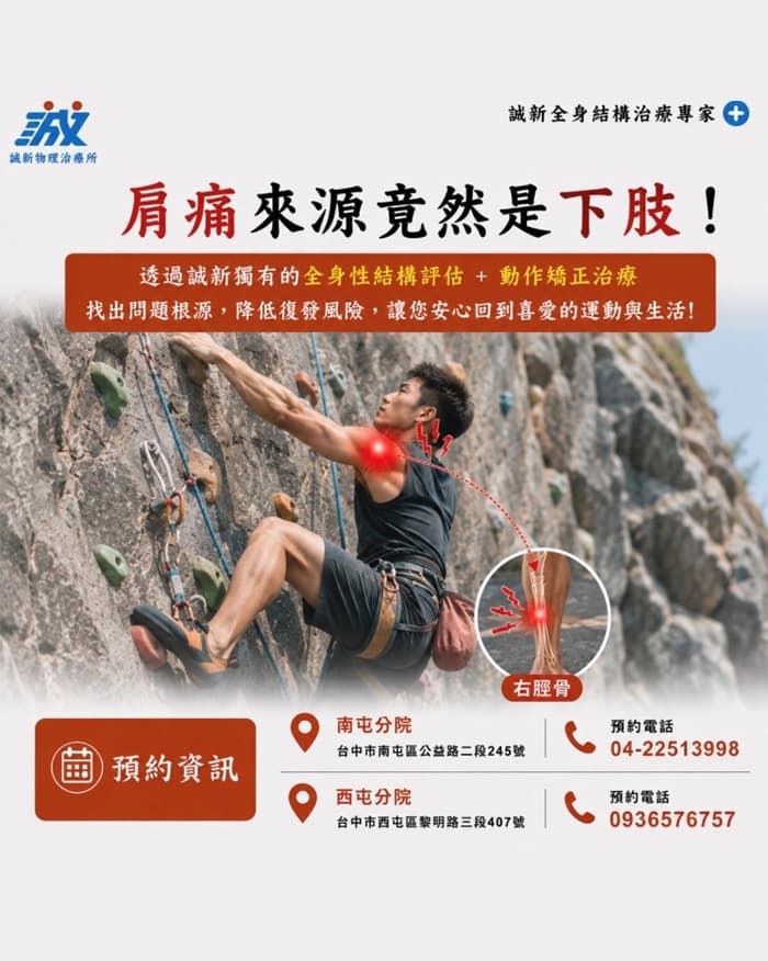 攀岩時覺得肩膀痠痛？從個案了解全身結構評估與疼痛因素